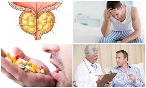 prostatīts vīriešiem