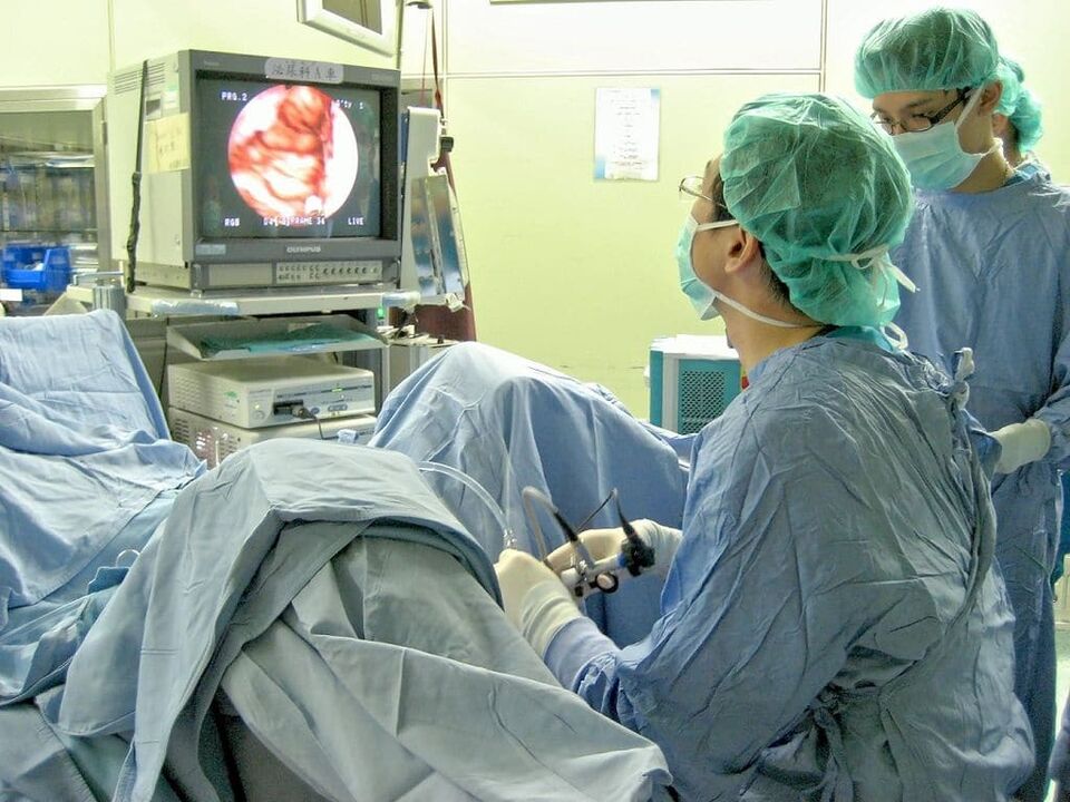 kaļķakmens prostatīta ķirurģiska ārstēšana